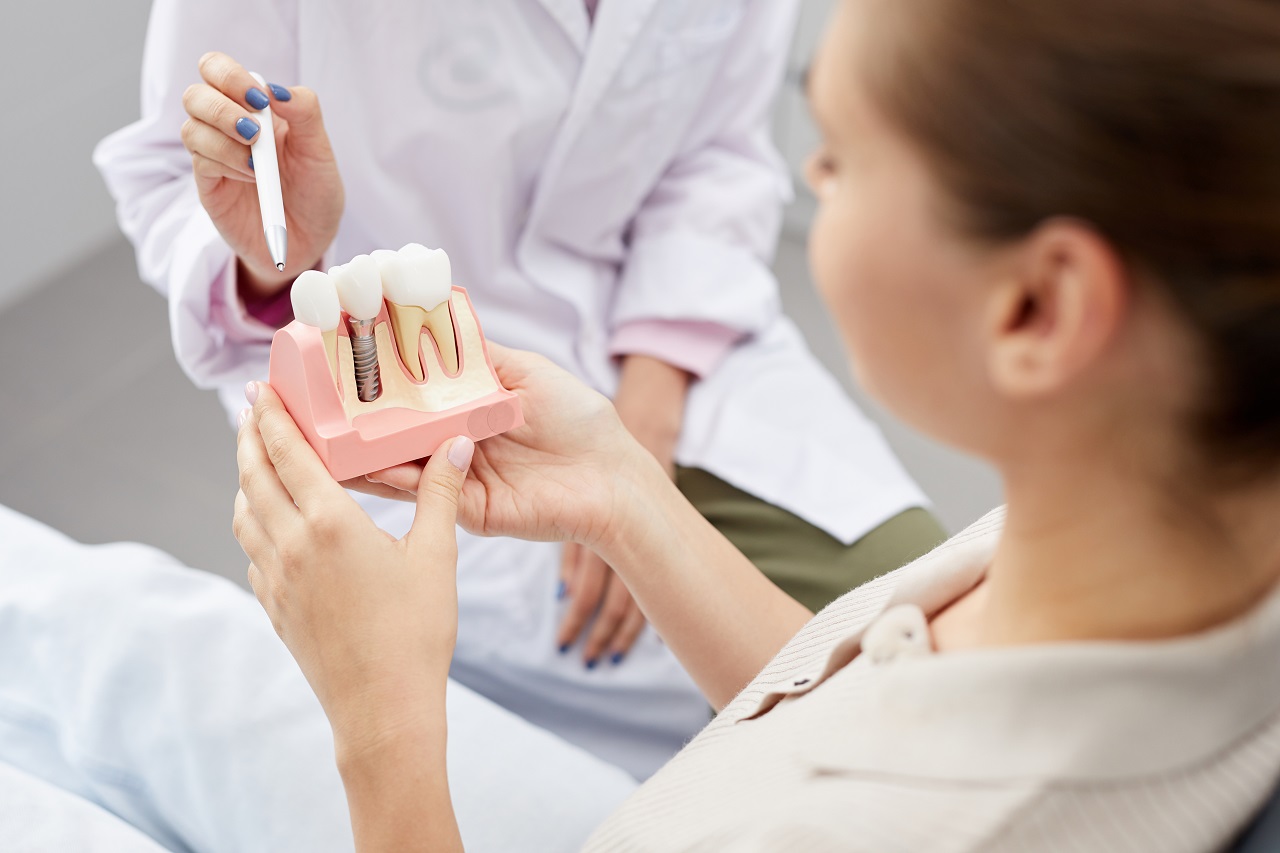 Dlaczego warto się zdecydować na implanty zębowe?
